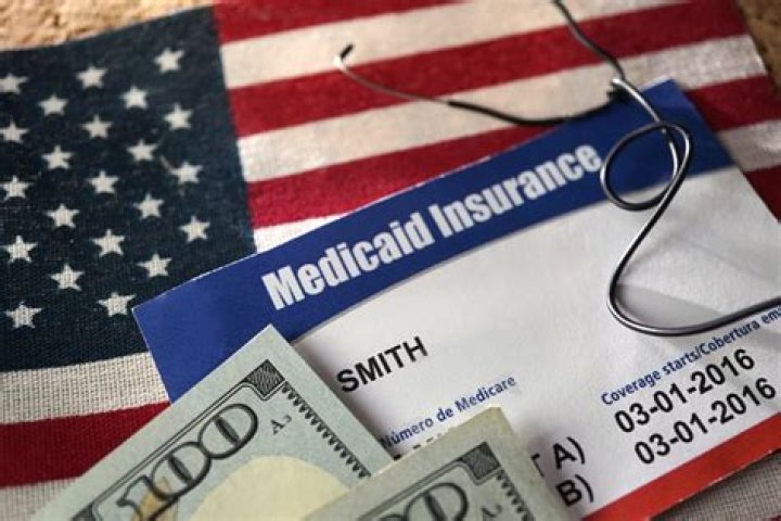 Does my parents income affect my Medicaid?